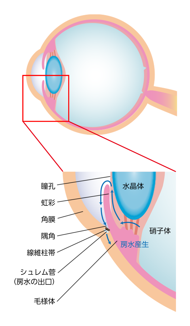 従来の緑内障手術とは